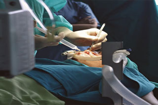 foley-catheter-at-home-in-gurgaon.jpg