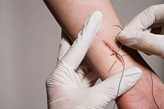 suture-removal-at-home-in-gurgaon.jpg