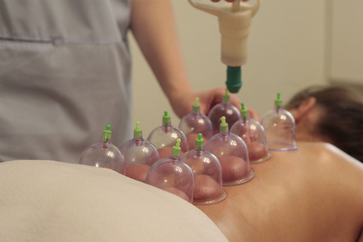 MedyHealth - Cupping Therapy at Home for Better Recovery in gurgaon delhi ncr