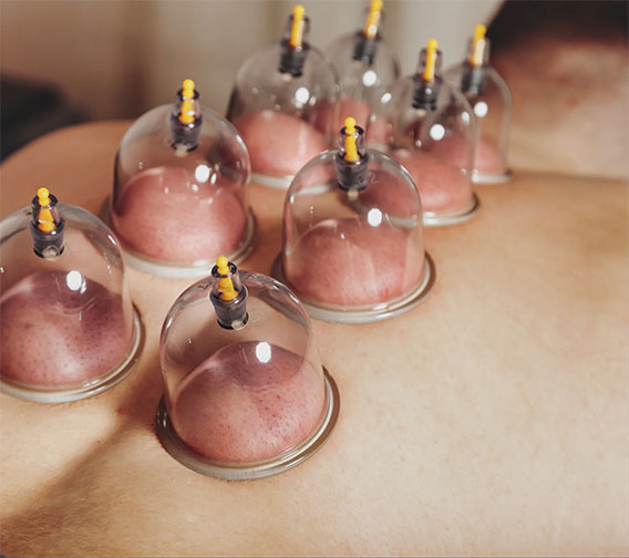 MedyHealth - Dry Cupping at Home near me in Gurgaon Dlehi NCR