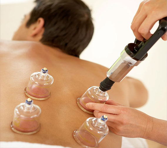 MedyHealth - Fire Cupping at Home near me in Gurgaon Dlehi NCR